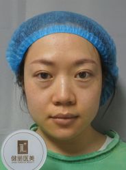 -天津健丽·去眼袋医疗美容机构