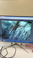 -碧莲盛·不剃发植发