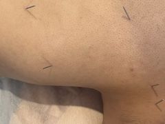 -名医堂永康中医·推拿正骨·针灸·艾灸