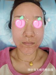 -和颜一美轻医美连锁