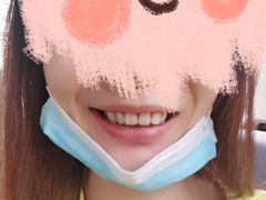 -团圆口腔·种植中心(锦江院区)