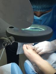 -派恩宜灰指甲鸡眼嵌甲手足癣