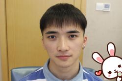 -大麦微针植发丨全国连锁