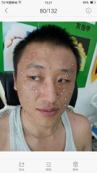 -百年美肤堂祛痦痣祛斑祛疣