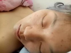-苗方清颜专业祛痘