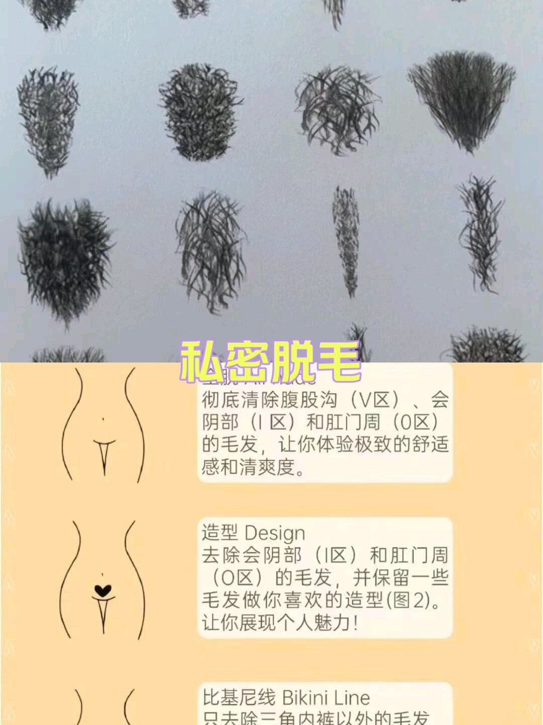 私密脱毛的好处