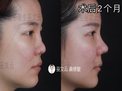 -北京米扬丽格医疗美容·联合丽格鼻整形中心