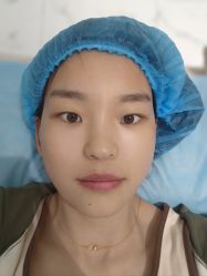 体验前-武汉颜范薇美医疗美容门诊部