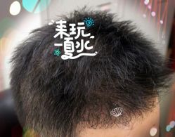 -大麦微针植发全国连锁