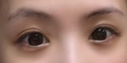 点击看大图 -变美丽半永久纹眉连锁·机器野生眉•洗眉