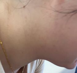 -美瑞莎创美医疗美容