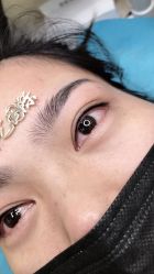 -郡艺医疗美容·微整·眼鼻吸脂