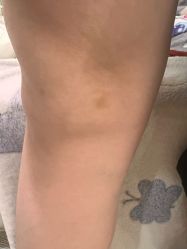 -洁铭新加坡医美