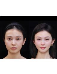 -上海伊莱美医疗美容医院