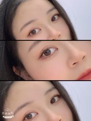 体验后-万州华美紫馨整形美容医院