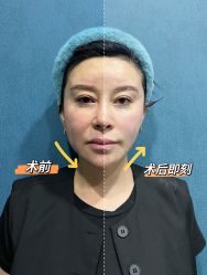 体验前-北京炫美医疗美容