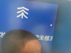 -雍禾植发全国连锁