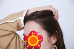 -大麦微针植发丨全国连锁