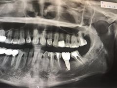 -希望齿科(河西店)