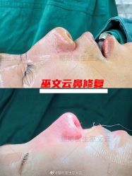 -北京米扬丽格医疗美容·联合丽格鼻整形中心