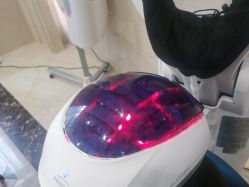 -碧莲盛·不剃发植发