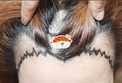 -大麦微针植发全国连锁