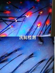 -顶尚堂白发脱发养发