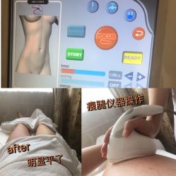 -茜尔维亚修身连锁(庆春银泰店)