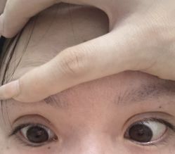 -洁铭新加坡医美