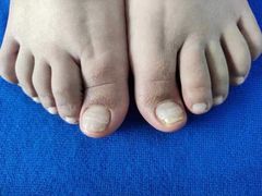 -世龙世家甲沟炎·灰指甲·嵌甲矫正·修脚(武侯区双楠店)