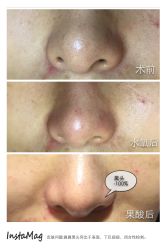 脸部抗衰-光SPA科技美肤