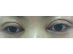 IMG0122A_1-上海华安整形外科门诊部