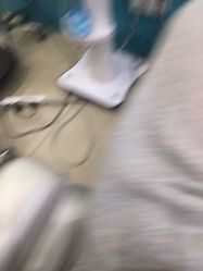 -黑奥秘脱发白发中心