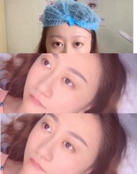 -久匠·纹眉半永久野生眉