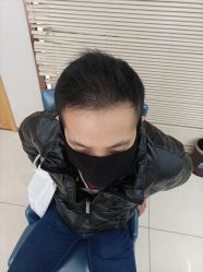 点击看大图 -大麦微针植发丨全国连锁