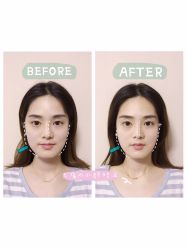 点击看大图 -FACE·日本小颜矫正美容整骨サロン