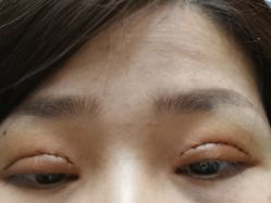 -西安壹加壹医疗美容医院