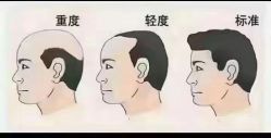 -希梵尔头皮抗衰·科技养发
