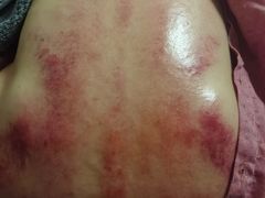 -左悦·艾灸调理·推拿按摩·精油SPA(卓悦汇店)
