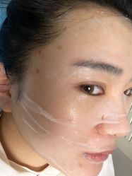 -圣嘉新医疗美容医院