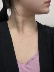 体验前-禾美嘉医疗美容