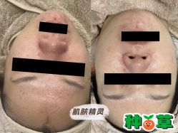 -哈颜科技轻美·