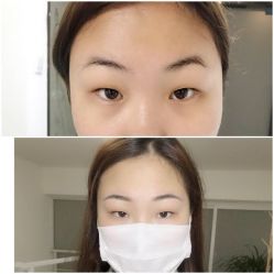 -Doris多里斯半永久纹眉·SMP纹发·发际线