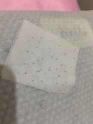 -苑苑vbeauty科技美容SPA