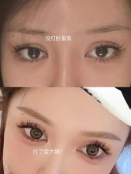 -Yestar 嘉兴艺星医疗美容医院