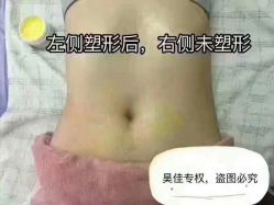 -华脉瘦身