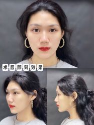 -美莱医疗美容医院