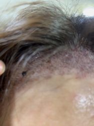 -熙朵美学植发·连锁品牌