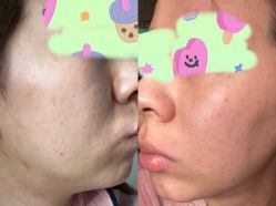 体验前-JS医疗美容