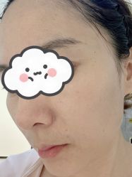 体验后-联合丽格·张菡丽格医疗美容